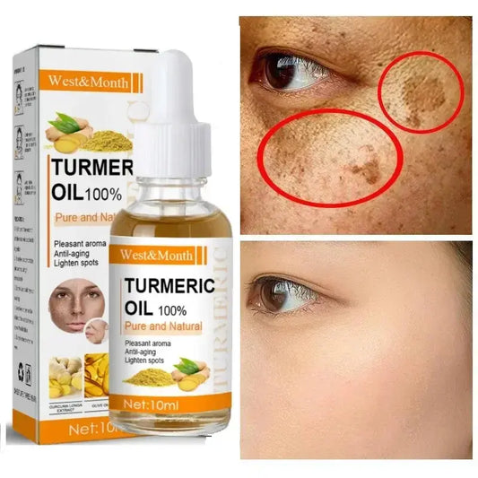 Remove Dark Spots Turmeric Essential Oil Anti Wrinkle Face Serum Therapeutic Acne Shrink Pores Whitening Moisturizing Skin Care