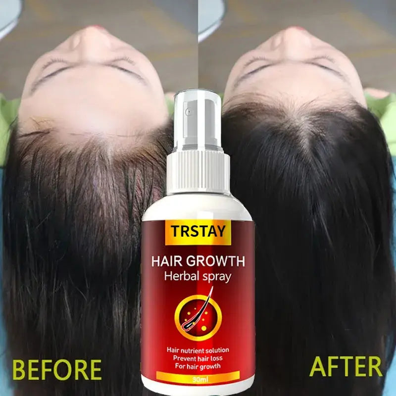 Hair Growth Serum Spray Fast Hair Growth Liquid Treatment Scalp Hair Follicle Anti Hair Loss Natural Beauty Health Hair Care